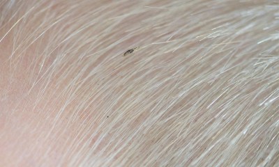 دليل الرجل للتعامل مع قمل العانة