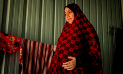 تشوهات الأجنة في غزة.. عوامل خطر العيوب الخلقية