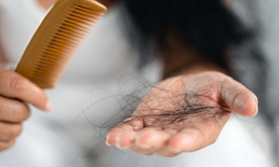 تساقط الشعر عند النساء
