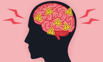 الدوالي قد تؤدي إلى تلف الدماغ