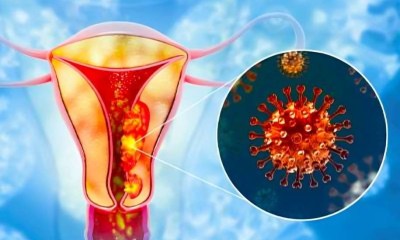 اعتماد أول اختبار منزلي لفحص سرطان عنق الرحم