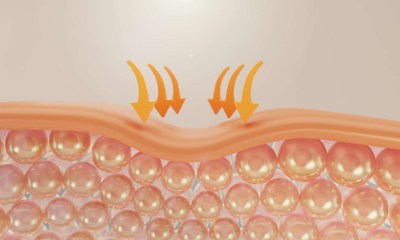 الأسباب الخفية لظهور الكتل تحت الجلد