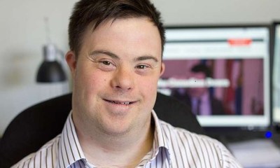 المصابون بمتلازمة داون أكثر عرضة للسكتات الدماغية بـ5 أضعاف