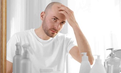 الصلع الوراثي عند الرجال.. أسبابه وأعراضه وطرق الوقاية