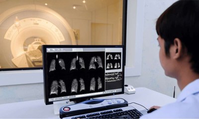 طفرة في تشخيص أمراض الرئة
