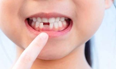 متى يبدأ الأطفال في فقدان الأسنان؟
