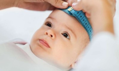 أعراض وأسباب ضخامة الرأس عند الأطفال