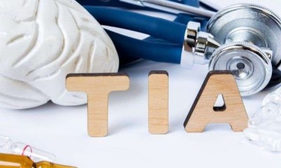 ما هي النوبة الإقفارية العابرة (TIA)؟