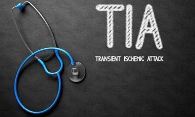 إنذار أحمر.. النوبة الإقفارية العابرة قد تكون مقدمة لسكتة دماغية قاتلة