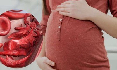 تأثير نقص الحديد أثناء الحمل عللى دماغ الأطفال