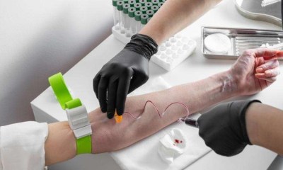 تبادل البلازما قد يقلل العمر البيولوجي سنتين ونصف