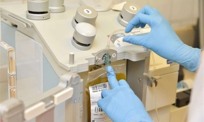 العلاج بالبلازما