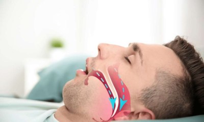  الاحتباس الحراري يفاقم أزمة انقطاع النفس النومي عالميا