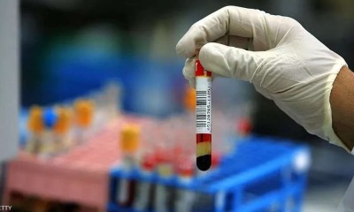 اختبار دم بسيط يخبرك كم عاماً ستعيش؟