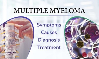 Multiple Myeloma