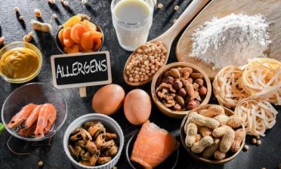 الحساسية الغذائية الوهمية أخطر من الحقيقية