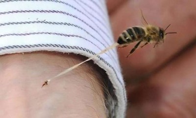 ماذا تفعل إذا لسع طفلك نحلة؟