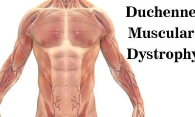 لماذا رفضت الـFDA دواء Deramiocel لعلاج ضمور العضلات الدوشيني؟