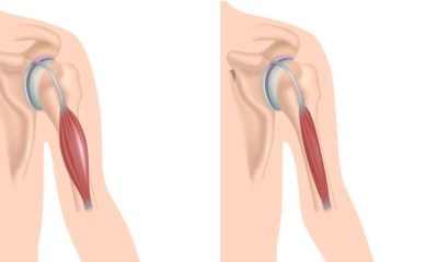 لماذا رفضت الـFDA دواء 