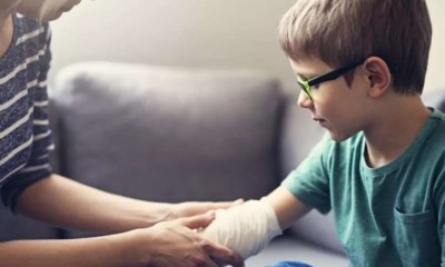 دليل شامل للتعامل مع حروق الأطفال في المنزل