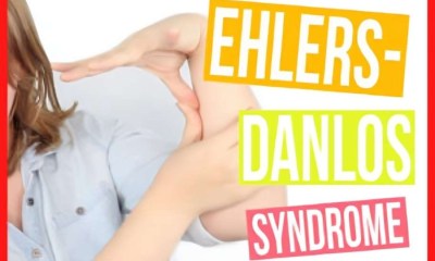 كيف يمكن التعايش مع متلازمة إهلرز دانلوس؟