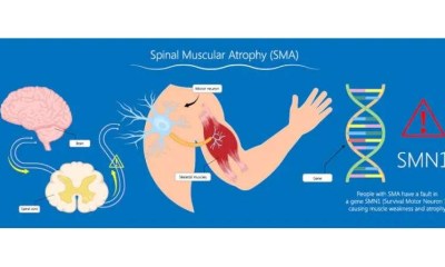 دواء واعد لضمور العضلات يحصل على تصنيف علاج ثوري من FDA