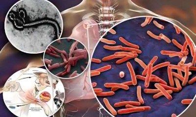 بكتيريا خفية تهدد حياتك… كيف تكتشف داء البريميات قبل فوات الأوان؟