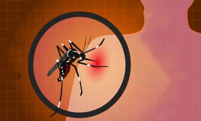 هل يوجد علاج لفيروس شيكونغونيا؟