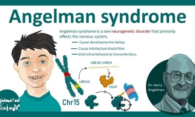 هل يعيش طفل متلازمة أنجلمان حياة طبيعية؟