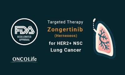 أمل جديد لمرضى أورام الرئة.. علاج ثوري يستهدف الطفرات النادرة