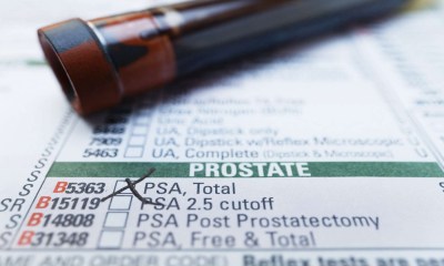 اختبار المستضد النوعي.. كيف ينبهك لعودة أورام البروستاتا؟