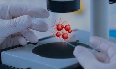 العلاج الخلوي يظهر نتائج واعدة مع الذئبة الحمراء