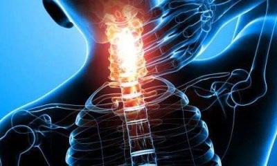 اكتشاف جديد يعد بعلاج أحد أخطر مضاعفات إصابات الحبل الشوكي