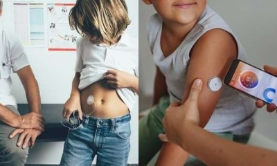 التكنولوجيا الطبية تحسن السيطرة على السكري من النوع الأول