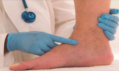 4 بدائل منزلية لتخفيف التورم أثناء الحمل