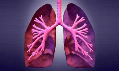 بخاخ يومي يظهر نتائج واعدة في علاج مرض رئوي نادر