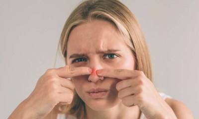 عصر البثور في هذه المنطقة ينقل العدوى مباشرة إلى الدماغ