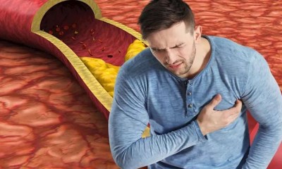 4 علامات على بشرتك تنذرك بارتفاع الكوليسترول