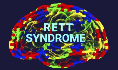 لماذا تصيب متلازمة ريت الإناث أكثر من الذكور؟