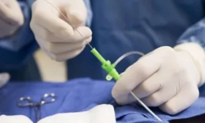 نجاح أول عملية منظار صدري لإصلاح رتق المريء لرضيع