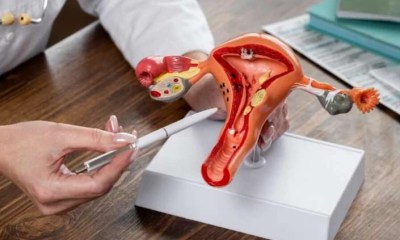 أورام عنق الرحم