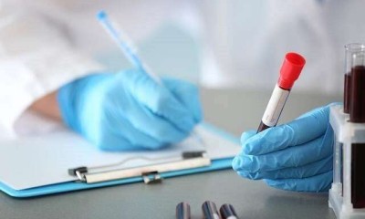 اختبار دم يتنبأ بأورام الرأس والعنق قبل 10 سنوات من ظهورها