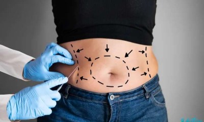  دواء تجريبي قد يغني عن جراحات السمنة