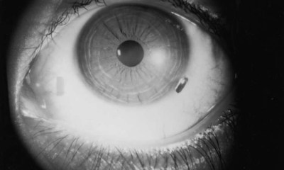 ماذا تفعل عند دخول نملة أو أي حشرة إلى العين؟