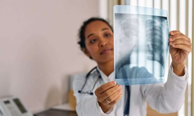 الالتهاب الرئوي عند الأطفال