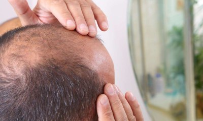 دواء ثوري يحفز نمو الشعر من جذوره