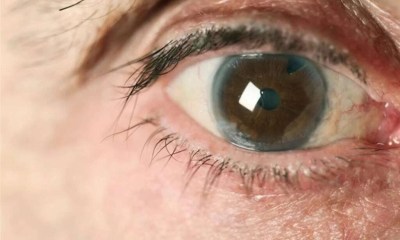 هل يؤدي انفصال شبكية العين إلى العمى؟