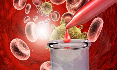 دراسة تشكك في فعالية اختبارات الدم للكشف المبكر عن الأورام