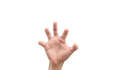 متلازمة اليد الغريبة