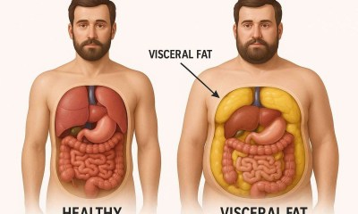 الدهون الحشوية تهدد حياتك
